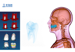 全口义齿多源数据融合及CAD/RP 系统赶超国际数字化口腔诊疗先进技术